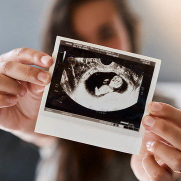 Frau hält Ultraschallbild in Kamera